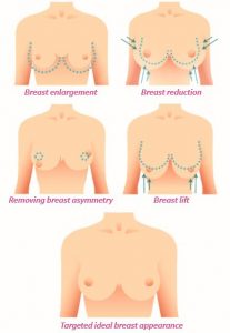 Breast Aesthetics  